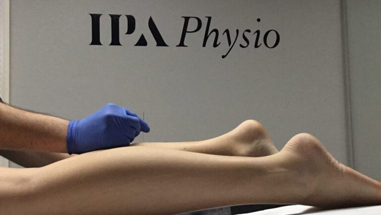 Getting to the Point – Dry Needling