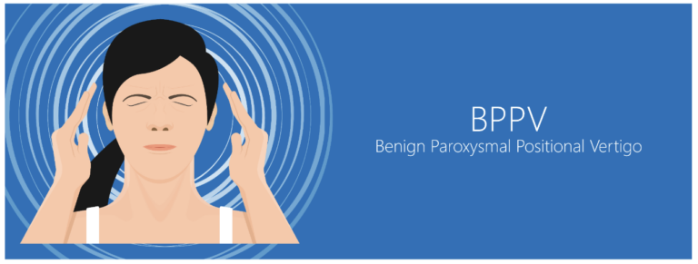 Could you have BPPV AKA Top Shelf or Positional Vertigo?